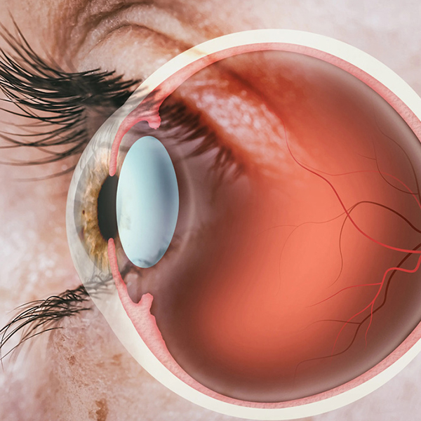 TOPOGRAFÍA CORNEAL Averclaro Clínica Oftalmológica