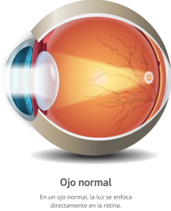 OJO-NORMAL-07