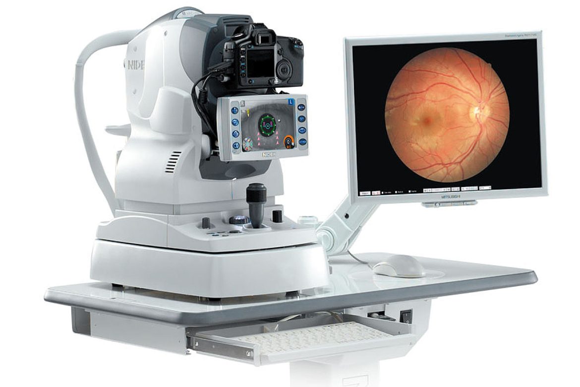 retinografo